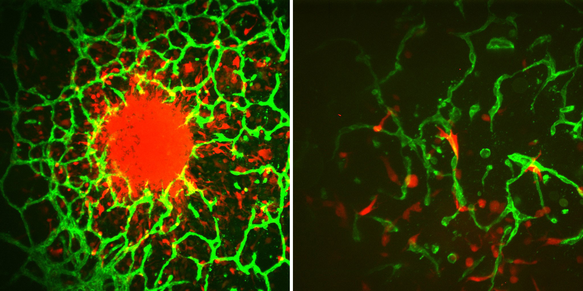 Left – Individual cells invade away from a central tumor spheroid and into the surrounding vascularized microenvironment. Tumor cells are shown in red and vasculature is shown in green. Right – Individual tumor cells (red) interact closely with surrounding vasculature (green). 