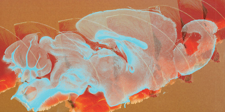 Scientist Collaborator Allison Yukiko Louie <br />
Andrew Steelman Laboratory <br />
Zeiss 710 Multiphoton Confocal Microscope <br />
Funded by the United States Department of Agriculture, University of Illinois at Urbana–Champaign start-up funds and the National Multiple Sclerosis Society Pilot Research Grant