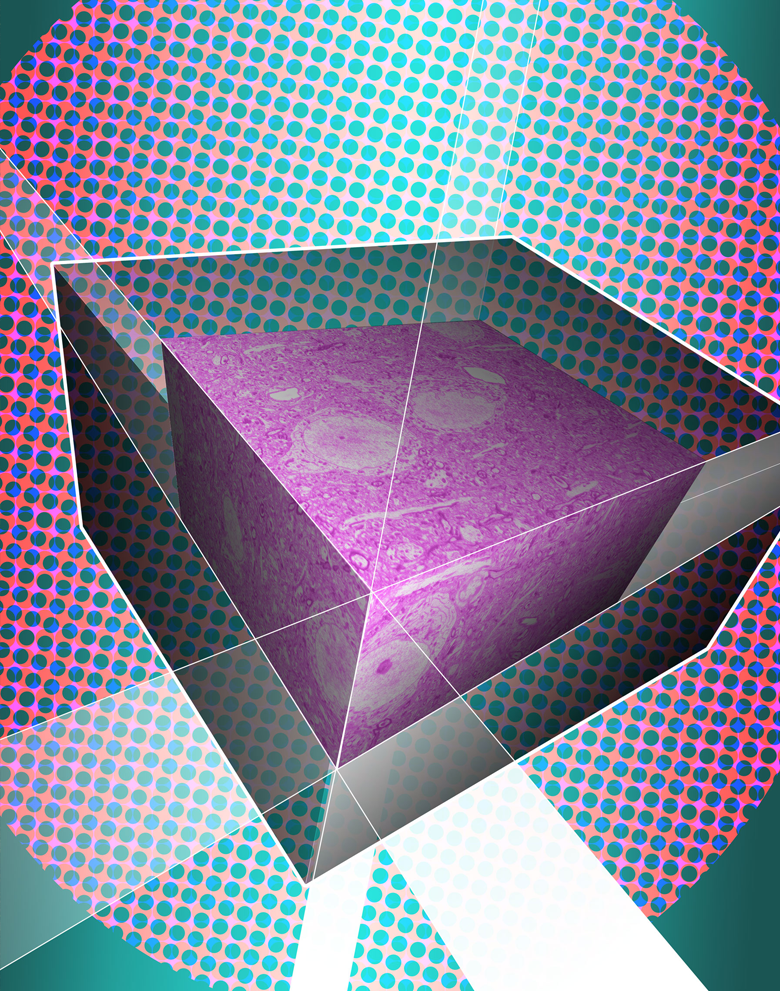 Zeiss Sigma VP 3View Serial Block-Face Scanning Electron Microscope <br />
Kingsley Boateng, Tom Bargar, and Anna Dunaevsky<br />
Anna Dunaevsky Laboratory<br />
Funded by the National Institutes of Health