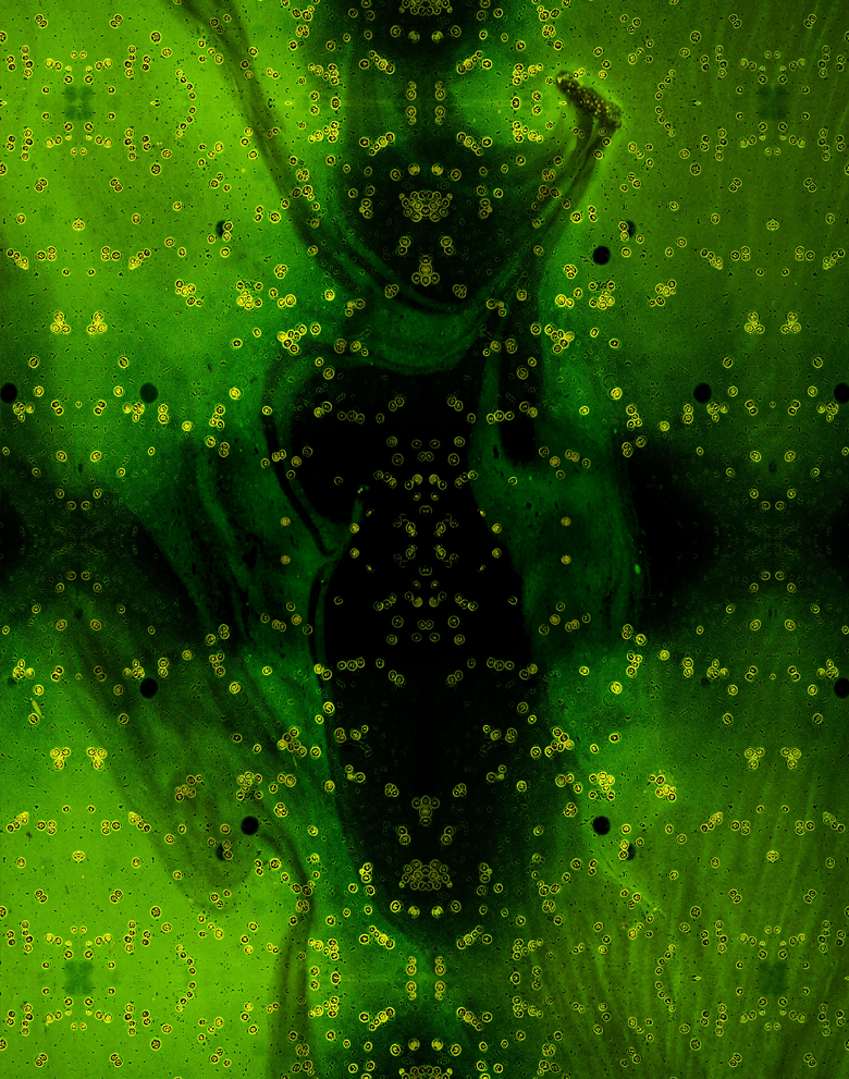 Zeiss Axiovert 200M Microscope <br />
Chandana Gopalakrishnappa<br />
Seppe Kuehn Laboratory<br />
Funded by the Gordon and Betty Moore Foundation and the University of Illinois