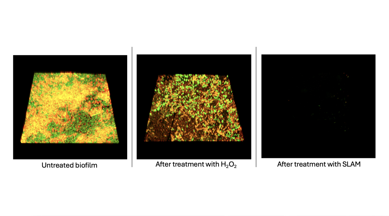 3D renderings of Pseudomonas aeruginosa biofilms show that treatment with SLAM particles can disrupt the bacterial biofilm and prevent regrowth.