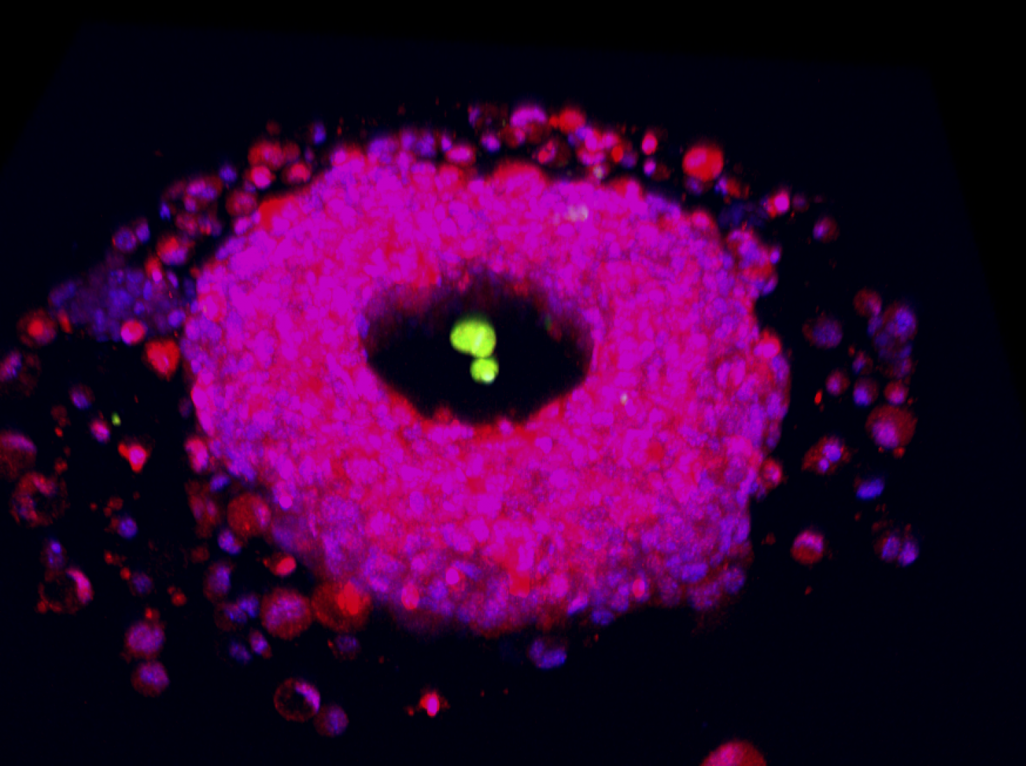 Liver progenitor cells (red) form a toroid shaped organoid around a PEG acrylate pillar. 