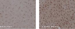 Immunohistochemical staining