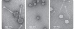 Electron micrographs of bacterial viruses, also known as phages. Photo credit is Hatoum-Aslan lab, University of Illinois Urbana-Champaign.