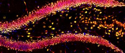 This image showcases the hippocampal region in a mouse brain slice, highlighting DAPI in blue, NeuN in green, and YAP in red using immunofluorescence.
