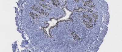 The tissue is from a mouse uterus that was stained with a Ki-67 antibody