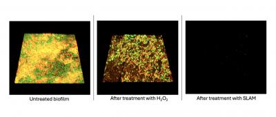 3D renderings of Pseudomonas aeruginosa biofilms show that treatment with SLAM particles can disrupt the bacterial biofilm and prevent regrowth.