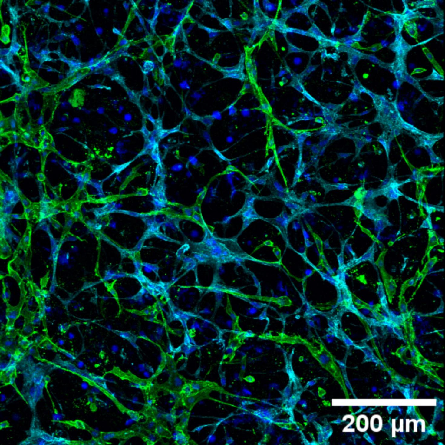 This is an image of a gelatin methacrylate model for the perivascular niche of the bone marrow.