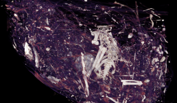 Reinterpreting Anatomy of a Nest