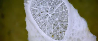 Remarkable materials, such as the rugged yet lightweight skeletons of deep-sea sponges, have inspired engineers to develop highly advanced metamaterials that can adapt to extreme environments. A new study is taking this concept to the next level by bridging the knowledge gap between macro- and nanoscale self-assembling materials to advance technologies in multiple fields, including robotics, mechanical engineering and information technology. Photo courtesy NOAA Okeanos Explorer Program