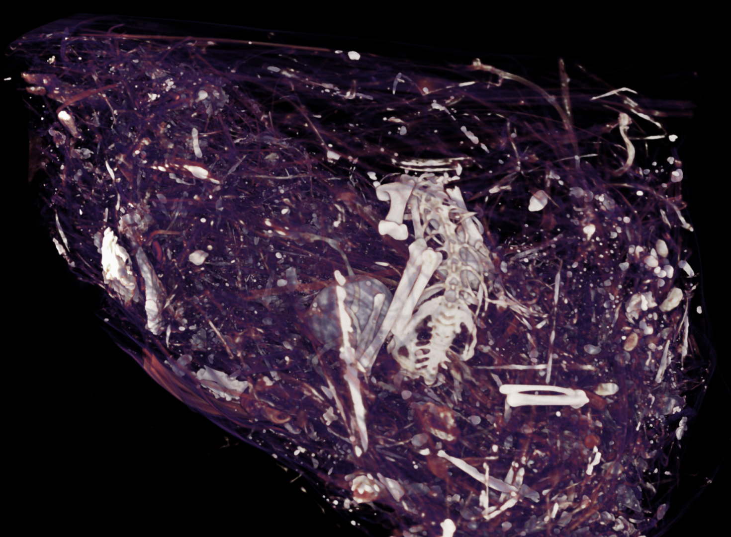 Reinterpreting Anatomy of a Nest