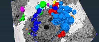 The image shows a 3D stack of SBF-SEM images of human pancreatic neuroendocrine cancer cells undergoing autophagy dependent cell death. Chloroquine inhibits autophagy by inhibiting the degradation of autolysosome. This 3D image clearly shows that accumulation of autophagic vacuoles (autophagosome and autolysosome) were detected in chloroquine treated BON (human pancreatic neuroendocrine cancer) cells. The image was taken using SBF-SEM at the Carle R. Woese Institute for Genomic Biology’s core facilities 